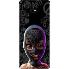 Casper Via A40 Kılıf Desenli Baskılı Tpu Rubber Kapak Swagg