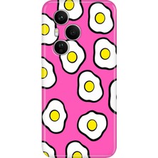 Adasena Honor 400 Pro Kılıf Desenli Baskılı Tpu Rubber Kapak Pink Eggs