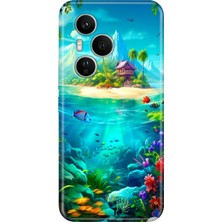 Senada Honor 400 Pro Kılıf Desenli Baskılı Tpu Rubber Kapak Island