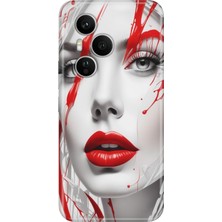 Adasena Honor 400 Pro Kılıf Desenli Baskılı Tpu Rubber Kapak Lady