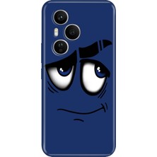 Senada Honor 400 Pro Kılıf Desenli Baskılı Tpu Rubber Kapak Acaba
