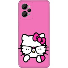 Senada Casper Via X30 Kılıf Desenli Baskılı Tpu Rubber Kapak Kitty/go