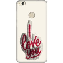 Adasena Huawei P9 Lite 2017 Kılıf Desenli Baskılı Tpu Rubber Kapak Love You