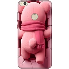 Adasena Huawei P9 Lite 2017 Kılıf Desenli Baskılı Tpu Rubber Kapak Pink Bear