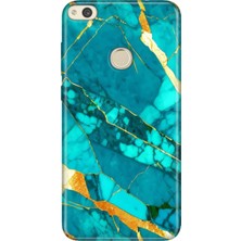 Adasena Huawei P9 Lite 2017 Kılıf Desenli Baskılı Tpu Rubber Kapak Pragmermer