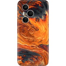 Adasena Honor 400 Pro Kılıf Desenli Baskılı Tpu Rubber Kapak Lav