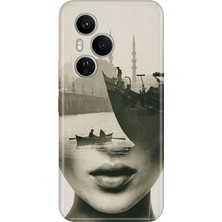 Senada Honor 400 Pro Kılıf Desenli Baskılı Tpu Rubber Kapak Istanbul