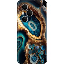 Senada Honor 400 Pro Kılıf Desenli Baskılı Tpu Rubber Kapak Arew Mermer
