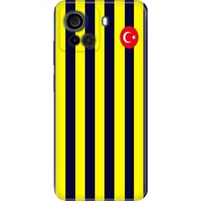 Senada Casper Via F30 Kılıf Desenli Baskılı Tpu Rubber Kapak Çubuklu Forma