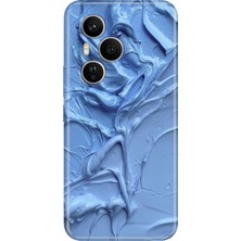 Adasena Honor 400 Pro Kılıf Desenli Baskılı Tpu Rubber Kapak Sanatsal