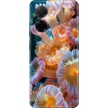 Adasena Xiaomi Redmi A5 Kılıf Desenli Baskılı Tpu Rubber Kapak Okyanustaki Hayat