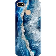 Adasena General Mobile Gm 8 Go Kılıf Desenli Baskılı Tpu Rubber Kapak Otto Marble