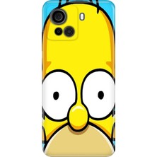 Casper Via F30 Kılıf Desenli Baskılı Tpu Rubber Kapak Simpsonface