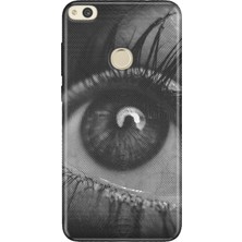 Senada Huawei P9 Lite 2017 Kılıf Desenli Baskılı Tpu Rubber Kapak Hologram Göz
