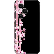 Adasena Honor 400 Pro Kılıf Desenli Baskılı Tpu Rubber Kapak Natural