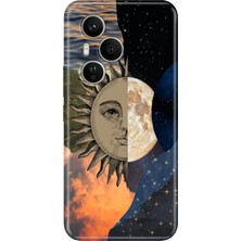 Honor 400 Pro Kılıf Desenli Baskılı Tpu Rubber Kapak Sunny