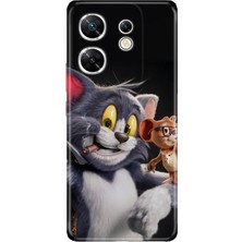 Senada Infinix Zero 30 4g Kılıf Desenli Baskılı Tpu Rubber Kapak Jerry And-Tom