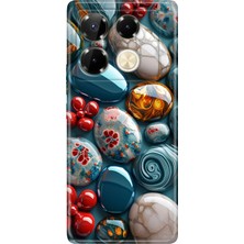 Senada Infinix Note 40 Pro 5g Kılıf Desenli Baskılı Tpu Rubber Kapak Çakıl Taşları