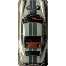 Senada General Mobile Phoneix 5g Kılıf Desenli Baskılı Tpu Rubber Kapak Klasik Araba