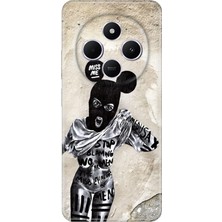 Senada Xiaomi Redmi A4 5g Kılıf Desenli Baskılı Tpu Rubber Kapak Artful Minnie