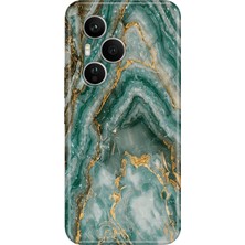Senada Honor 400 Pro Kılıf Desenli Baskılı Tpu Rubber Kapak Granit