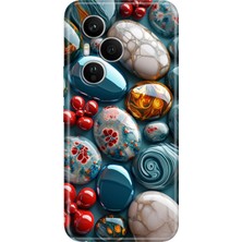 Senada Honor 400 Pro Kılıf Desenli Baskılı Tpu Rubber Kapak Çakıl Taşları