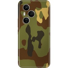 Senada Honor 400 Pro Kılıf Desenli Baskılı Tpu Rubber Kapak Çöl Askeri