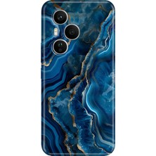 Senada Honor 400 Pro Kılıf Desenli Baskılı Tpu Rubber Kapak Dark Ametist