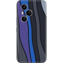 Senada Honor 400 Pro Kılıf Desenli Baskılı Tpu Rubber Kapak Insider