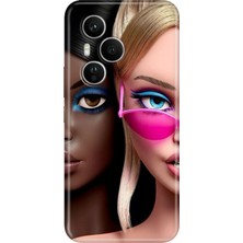 Senada Honor 400 Pro Kılıf Desenli Baskılı Tpu Rubber Kapak Kankalar