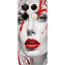 Infinix Note 40 Pro 5g Kılıf Desenli Baskılı Tpu Rubber Kapak Lady