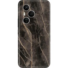 Senada Honor 400 Pro Kılıf Desenli Baskılı Tpu Rubber Kapak Bloom Mermer