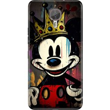 Senada General Mobile Gm 5 Plus Kılıf Desenli Baskılı Tpu Rubber Kapak King-Mickey