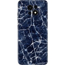 Senada Casper Via M30 Kılıf Desenli Baskılı Tpu Rubber Kapak Dark Blue