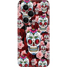 Senada Honor 400 Pro Kılıf Desenli Baskılı Tpu Rubber Kapak Kabile