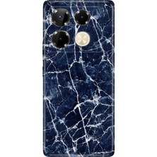 Senada Infinix Note 40 Pro 5g Kılıf Desenli Baskılı Tpu Rubber Kapak Dark Blue