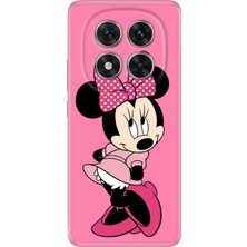 Xiaomi Redmi Note 14 Pro 5g Kılıf Desenli Baskılı Tpu Rubber Kapak Utangaç Minnie