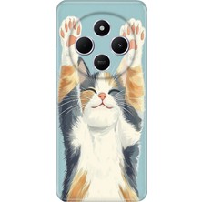 Senada Xiaomi Redmi A4 5g Kılıf Desenli Baskılı Tpu Rubber Kapak Eller Yukarı