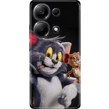 Senada Xiaomi Redmi Note 13 Pro 4g Kılıf Desenli Baskılı Tpu Rubber Kapak Jerry And-Tom