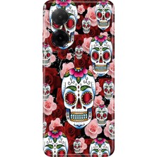 Senada Xiaomi Redmi A5 Kılıf Desenli Baskılı Tpu Rubber Kapak Kabile