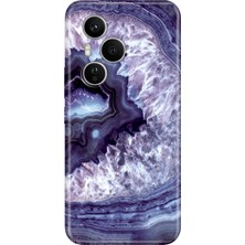 Senada Honor 400 Pro Kılıf Desenli Baskılı Tpu Rubber Kapak Elmas