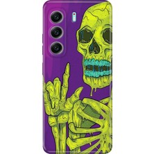 Senada Tecno Camon 40 4g Kılıf Desenli Baskılı Tpu Rubber Kapak Iskelet 111