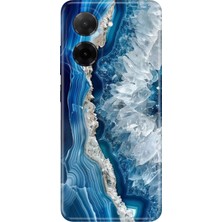 Xiaomi Redmi A5 Kılıf Desenli Baskılı Tpu Rubber Kapak Otto Marble