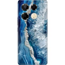 Infinix Note 40 Pro 5g Kılıf Desenli Baskılı Tpu Rubber Kapak Otto Marble