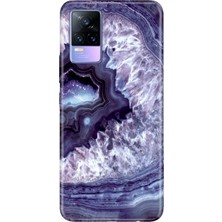 Senada Vivo V21E Kılıf Desenli Baskılı Tpu Rubber Kapak Elmas