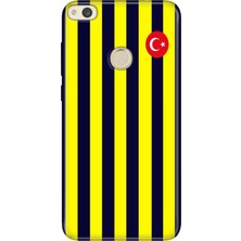 Senada Huawei P9 Lite 2017 Kılıf Desenli Baskılı Tpu Rubber Kapak Çubuklu Forma