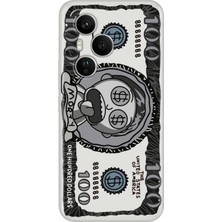 Adasena Honor 400 Pro Kılıf Desenli Baskılı Tpu Rubber Kapak 100 Usd