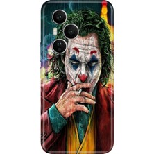 Senada Honor 400 Pro Kılıf Desenli Baskılı Tpu Rubber Kapak Jokker