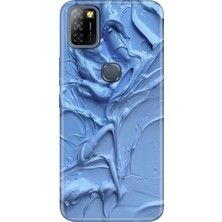 Adasena Infinix Smart 5 Kılıf Desenli Baskılı Tpu Rubber Kapak Sanatsal