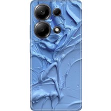 Adasena Xiaomi Redmi Note 13 Pro 4g Kılıf Desenli Baskılı Tpu Rubber Kapak Sanatsal